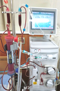 最新の機械でオンラインHDF治療