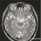 ◎頭部ＭＲＩ検査