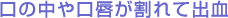 口の中や口唇が割れて出血